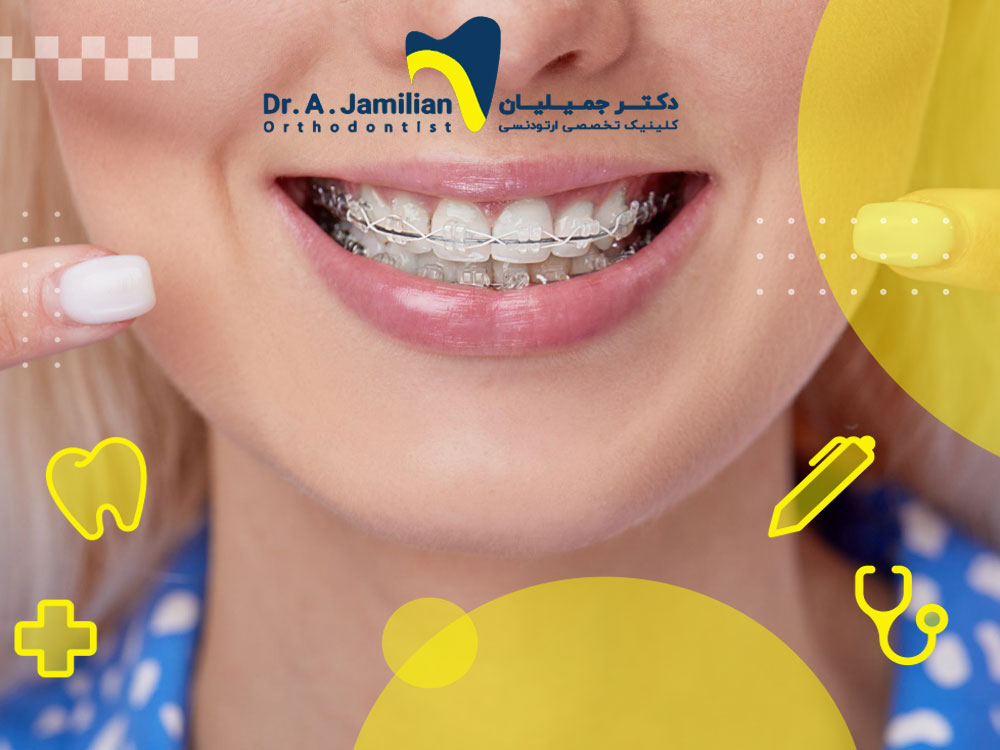 بیماری که به نحوه مراقبت از ارتودنسی سرامیکی خود اشاره می کند