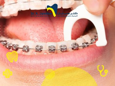 بیمار در حال کشیدن نخ دندان که برای حفظ سلامت دندان ارتودنسی شده ضروری است