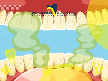 بوی بد دندان خراب و پوسیده و راهکارهای علمی و فوری کاهش بوی بد دهان