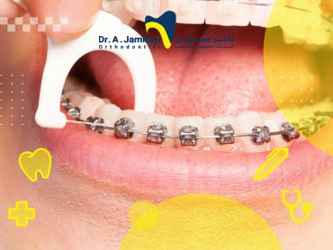 بیمار در حال کشیدن نخ دندان که برای حفظ سلامت دندان ارتودنسی شده ضروری است