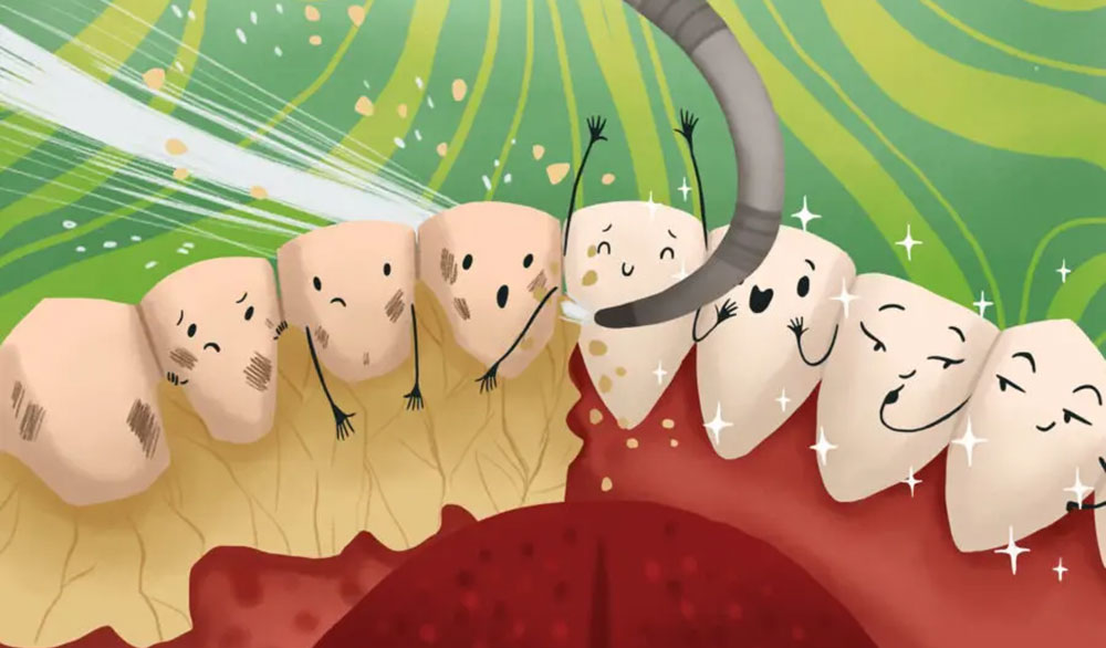 جرم گیری دندان ها به منظور کاهش بوی بد دهان و دندان خراب